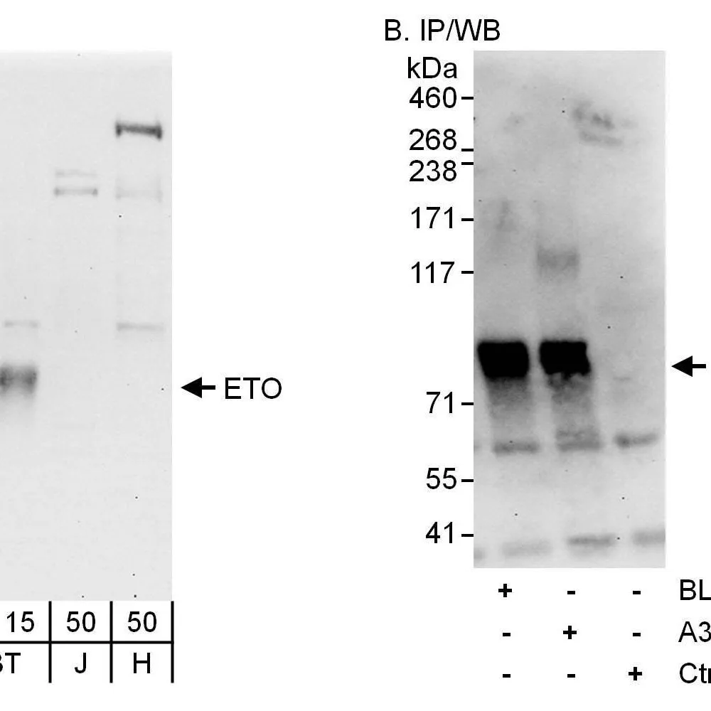 Rabbit anti-ETO Antibody, Affinity Purified