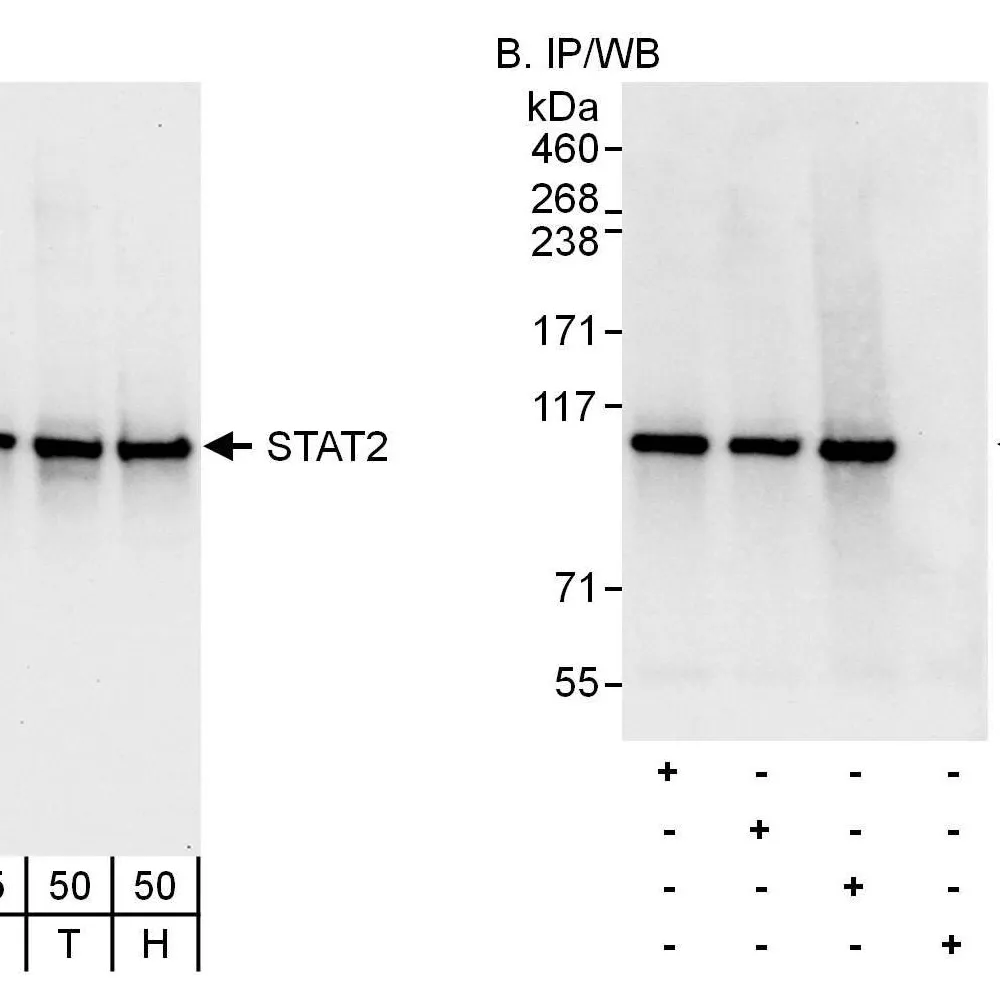 Rabbit anti-STAT2 Antibody, Affinity Purified