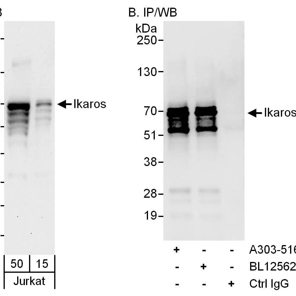 Rabbit anti-Ikaros Antibody, Affinity Purified