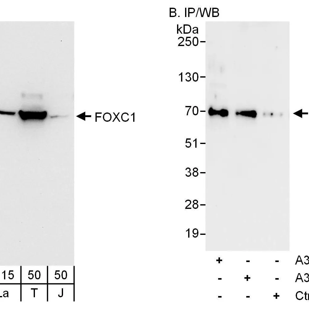 Rabbit anti-FOXC1 Antibody, Affinity Purified