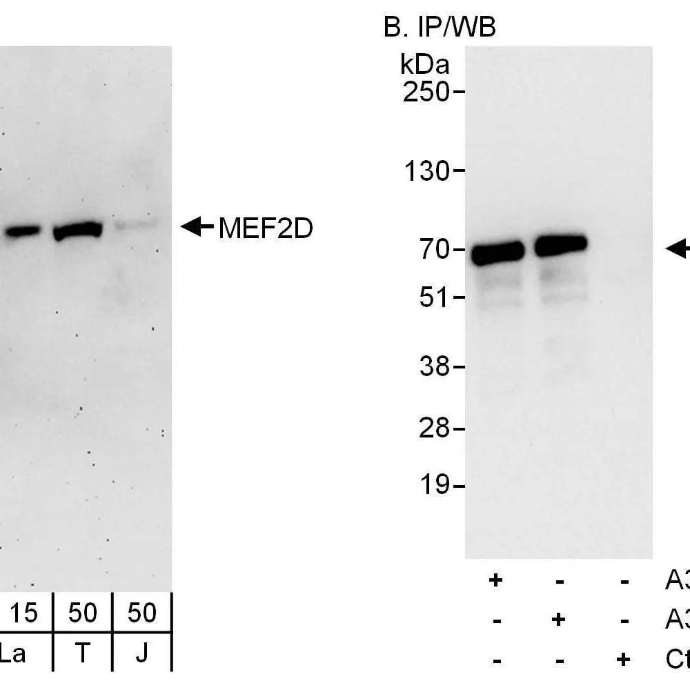 Rabbit anti-MEF2D Antibody, Affinity Purified