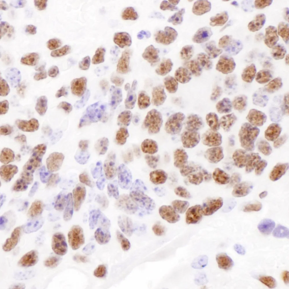 Rabbit anti-PABPN1 Antibody, Affinity Purified