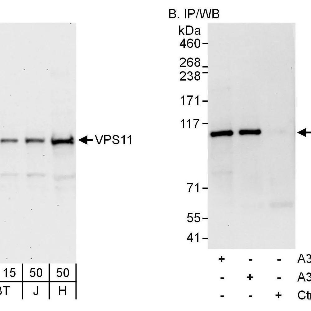 Rabbit anti-VPS11 Antibody, Affinity Purified