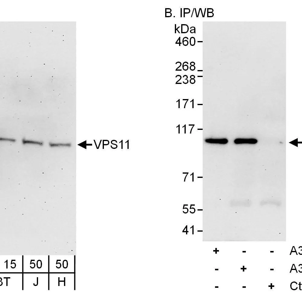 Rabbit anti-VPS11 Antibody, Affinity Purified