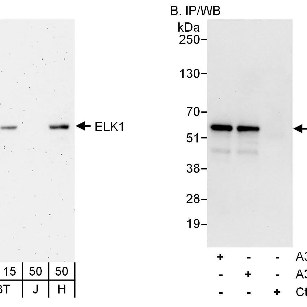 Rabbit anti-ELK1 Antibody, Affinity Purified