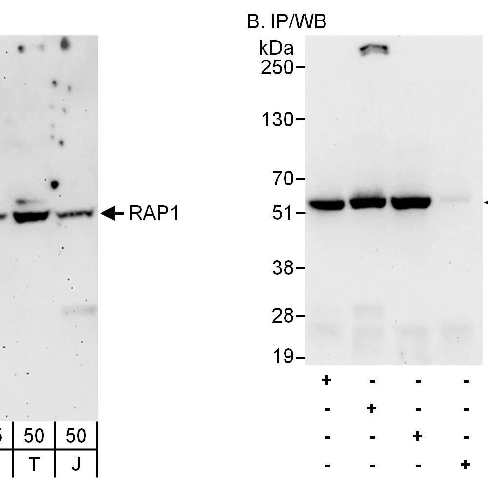 Rabbit anti-RAP1 Antibody, Affinity Purified