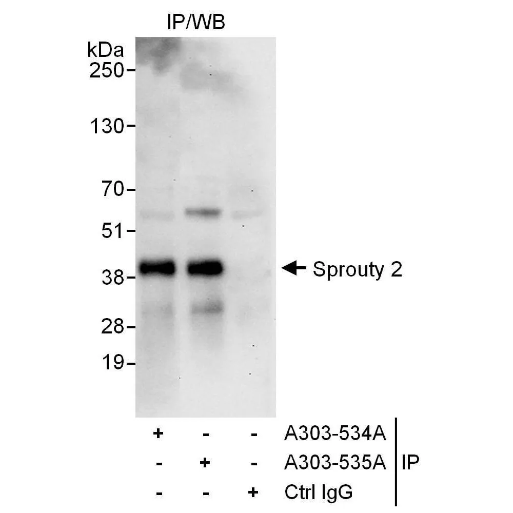 Rabbit anti-Sprouty 2 Antibody, Affinity Purified
