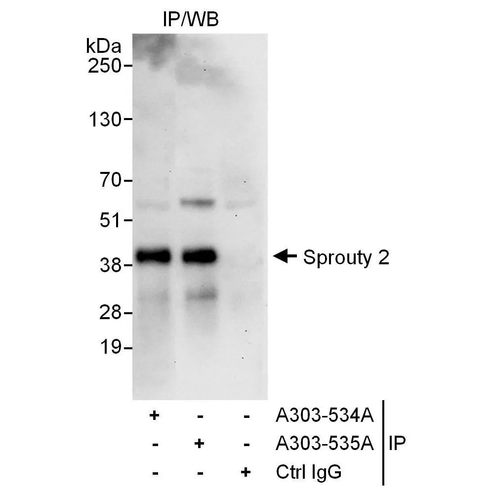 Rabbit anti-Sprouty 2 Antibody, Affinity Purified