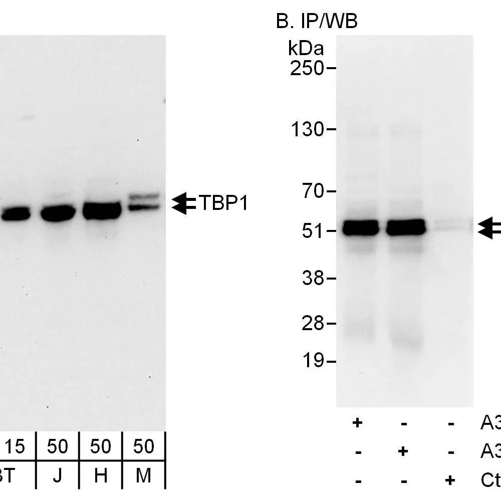 Rabbit anti-TBP1 Antibody, Affinity Purified