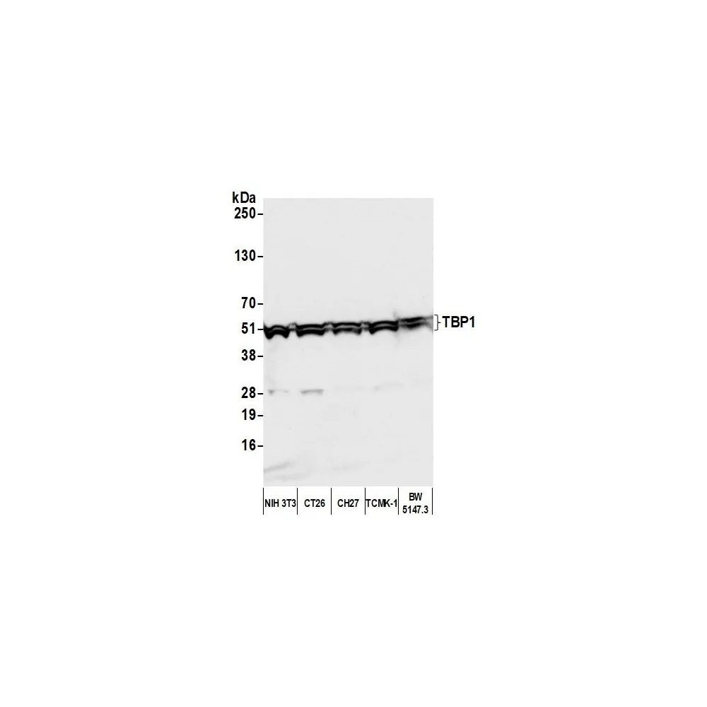 Rabbit anti-TBP1 Antibody, Affinity Purified