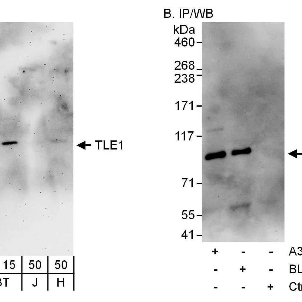 Rabbit anti-TLE1 Antibody, Affinity Purified