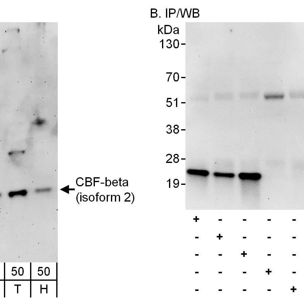 Rabbit anti-CBF-beta (isoform 2) Antibody, Affinity Purified