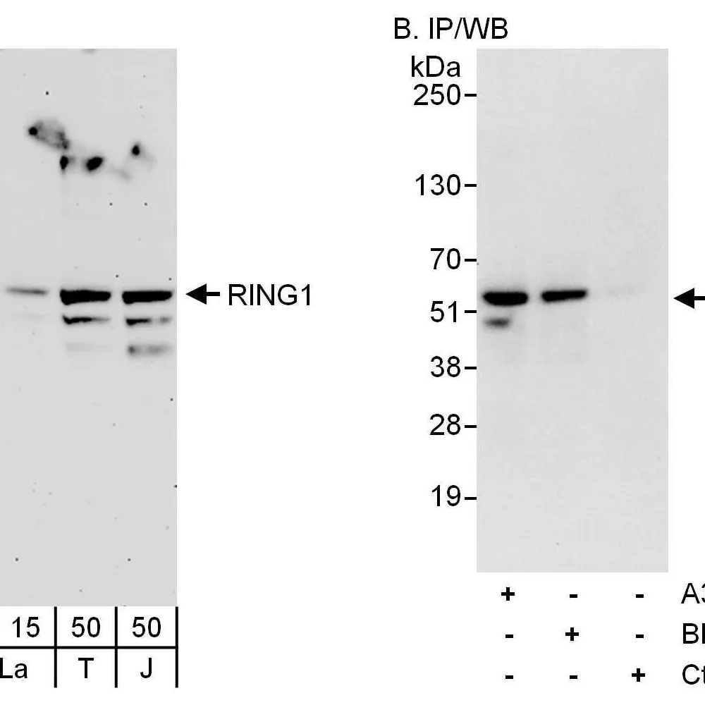 Rabbit anti-RING1 Antibody, Affinity Purified