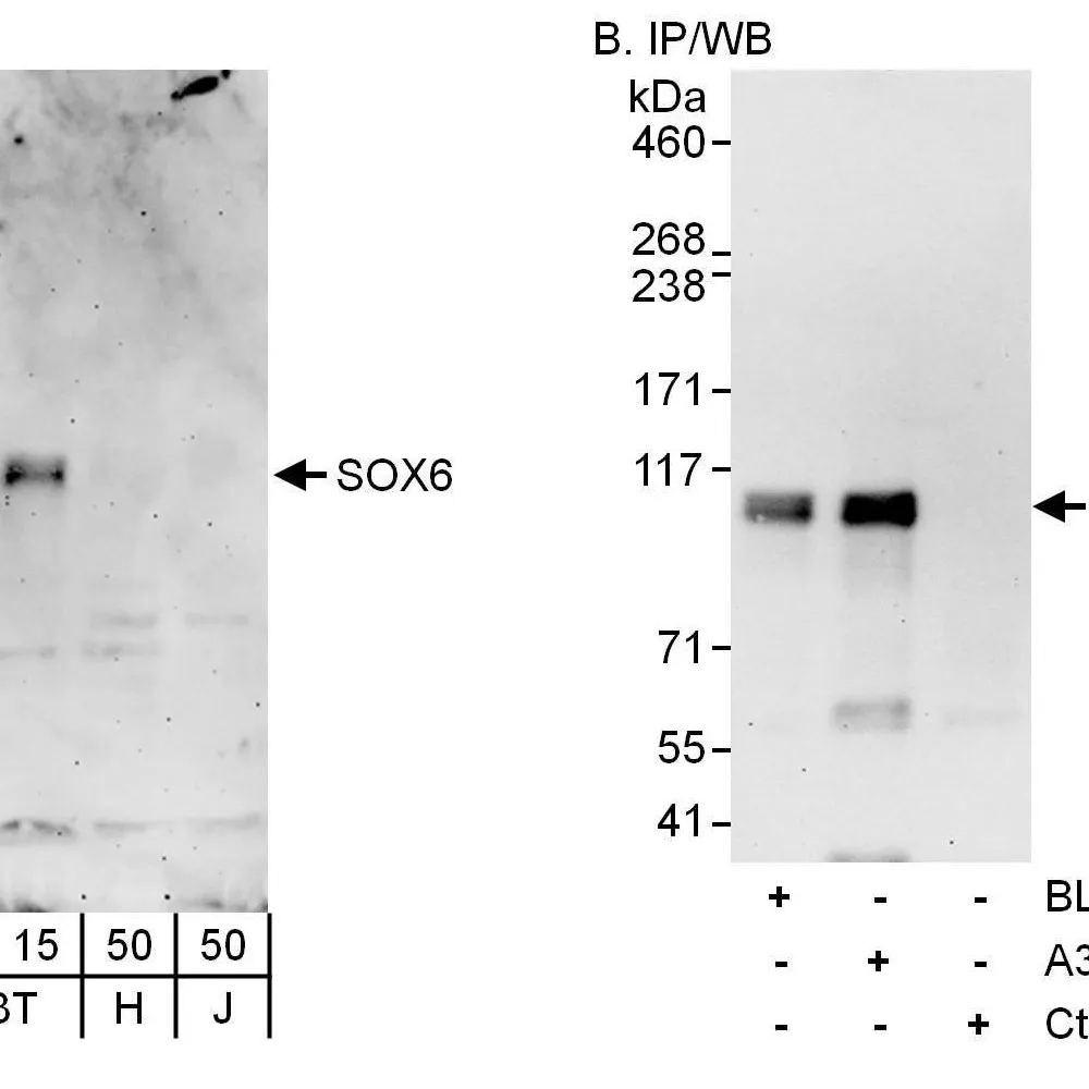 Rabbit anti-SOX6 Antibody, Affinity Purified