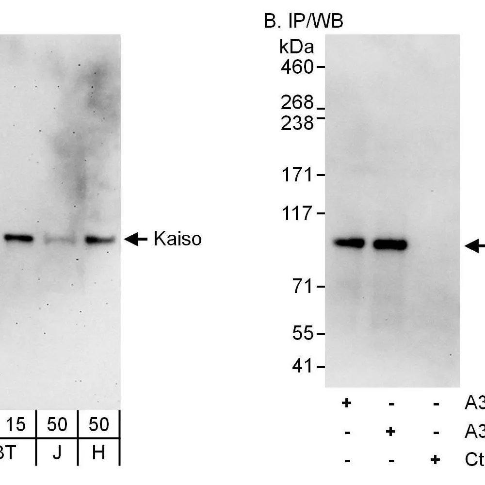 Rabbit anti-Kaiso Antibody, Affinity Purified