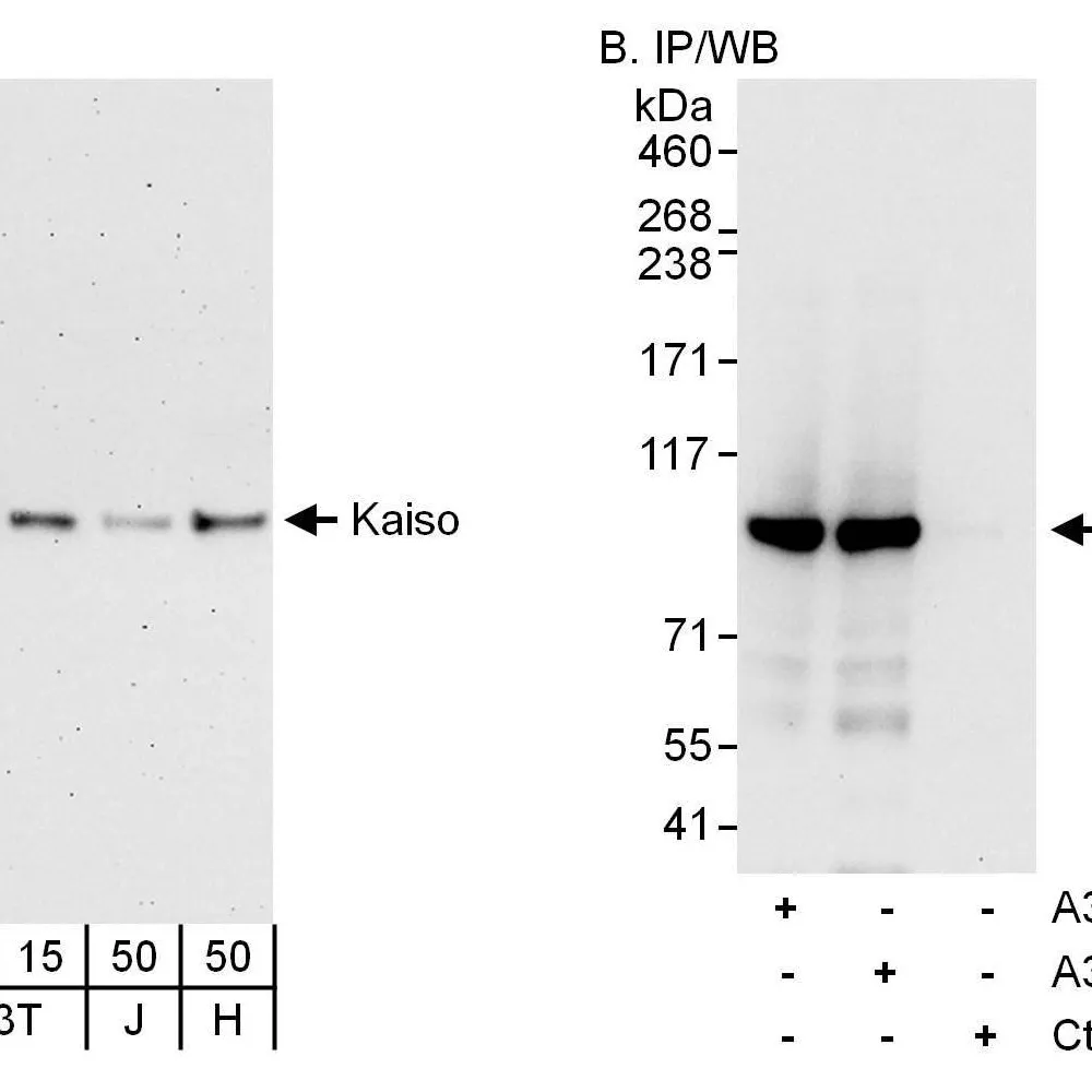 Rabbit anti-Kaiso Antibody, Affinity Purified