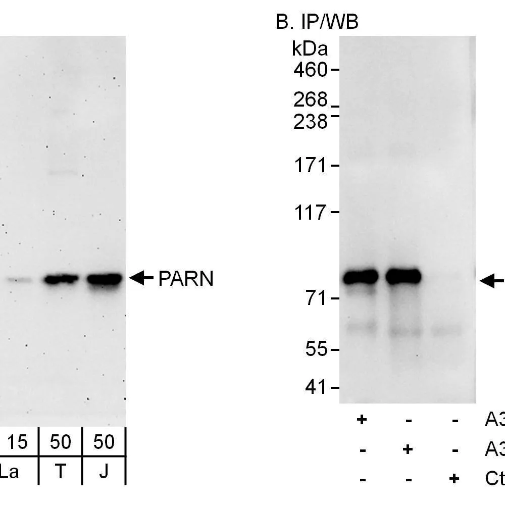 Rabbit anti-PARN Antibody, Affinity Purified