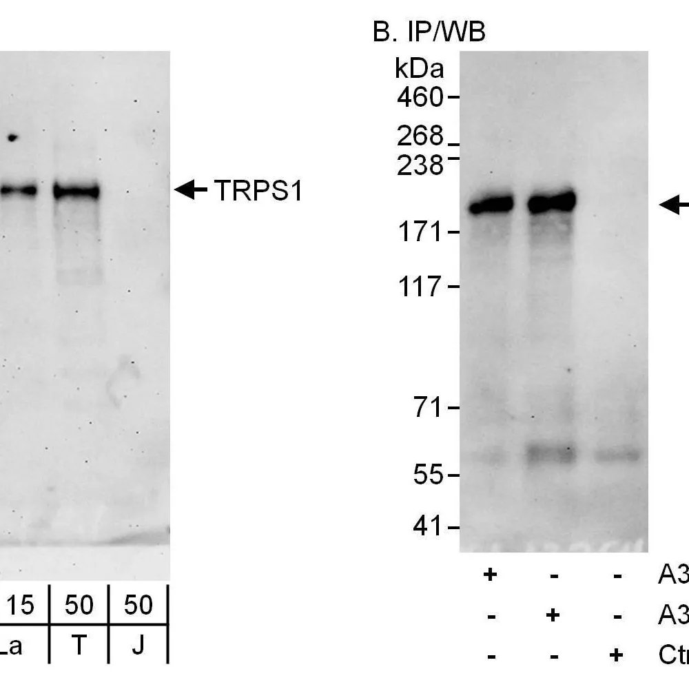 Rabbit anti-TRPS1 Antibody, Affinity Purified