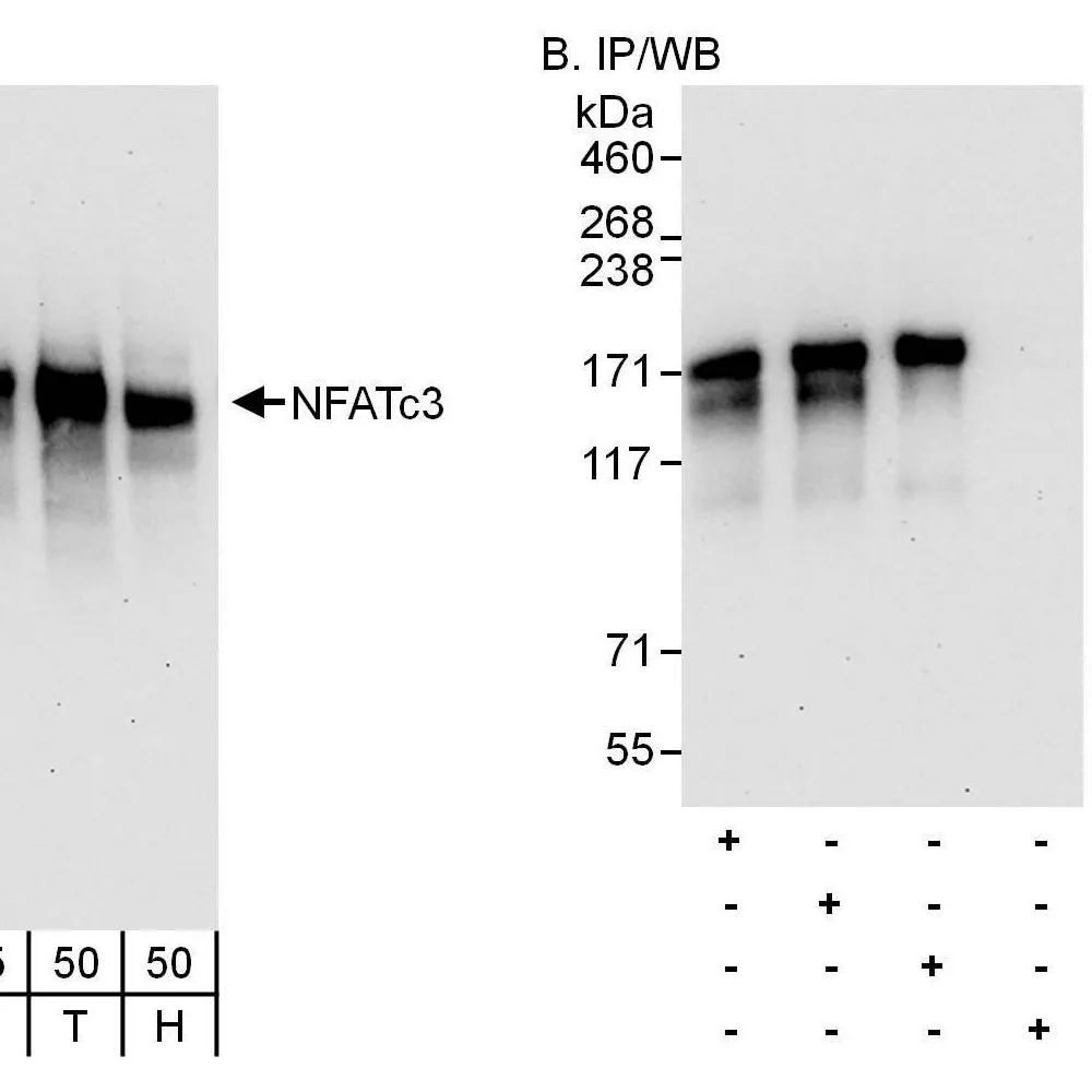 Rabbit anti-NFATc3 Antibody, Affinity Purified