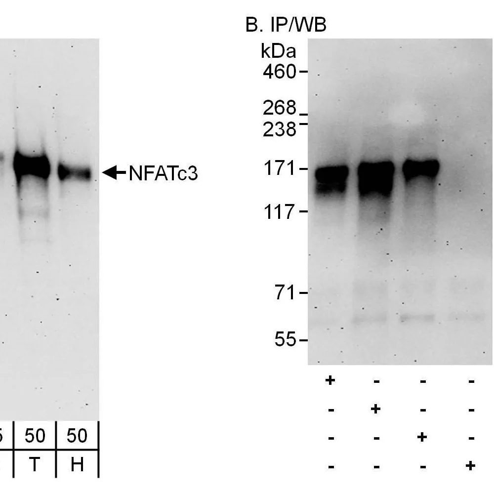 Rabbit anti-NFATc3 Antibody, Affinity Purified