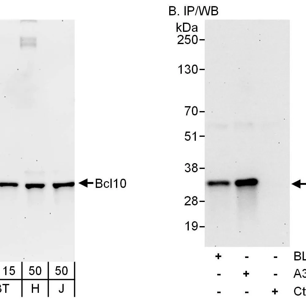 Rabbit anti-Bcl10 Antibody, Affinity Purified