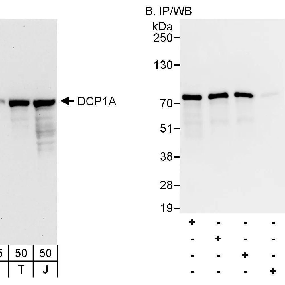 Rabbit anti-DCP1A Antibody, Affinity Purified