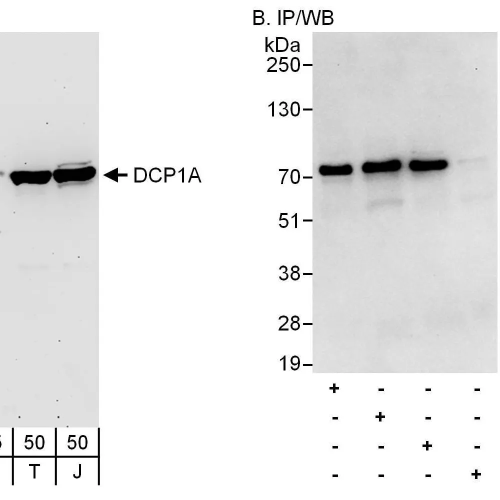 Rabbit anti-DCP1A Antibody, Affinity Purified