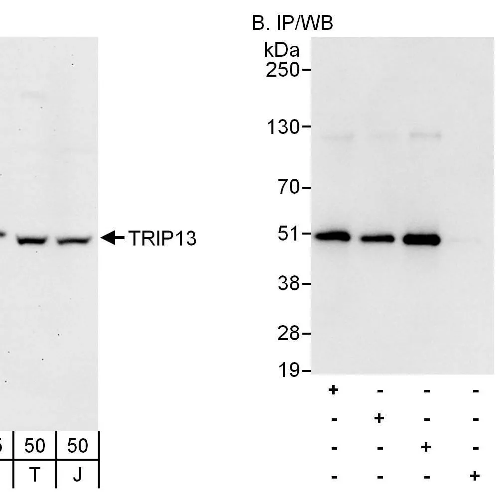 Rabbit anti-TRIP13 Antibody, Affinity Purified