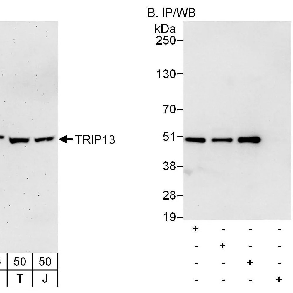 Rabbit anti-TRIP13 Antibody, Affinity Purified
