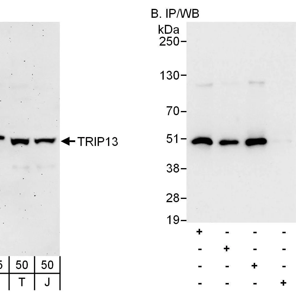 Rabbit anti-TRIP13 Antibody, Affinity Purified