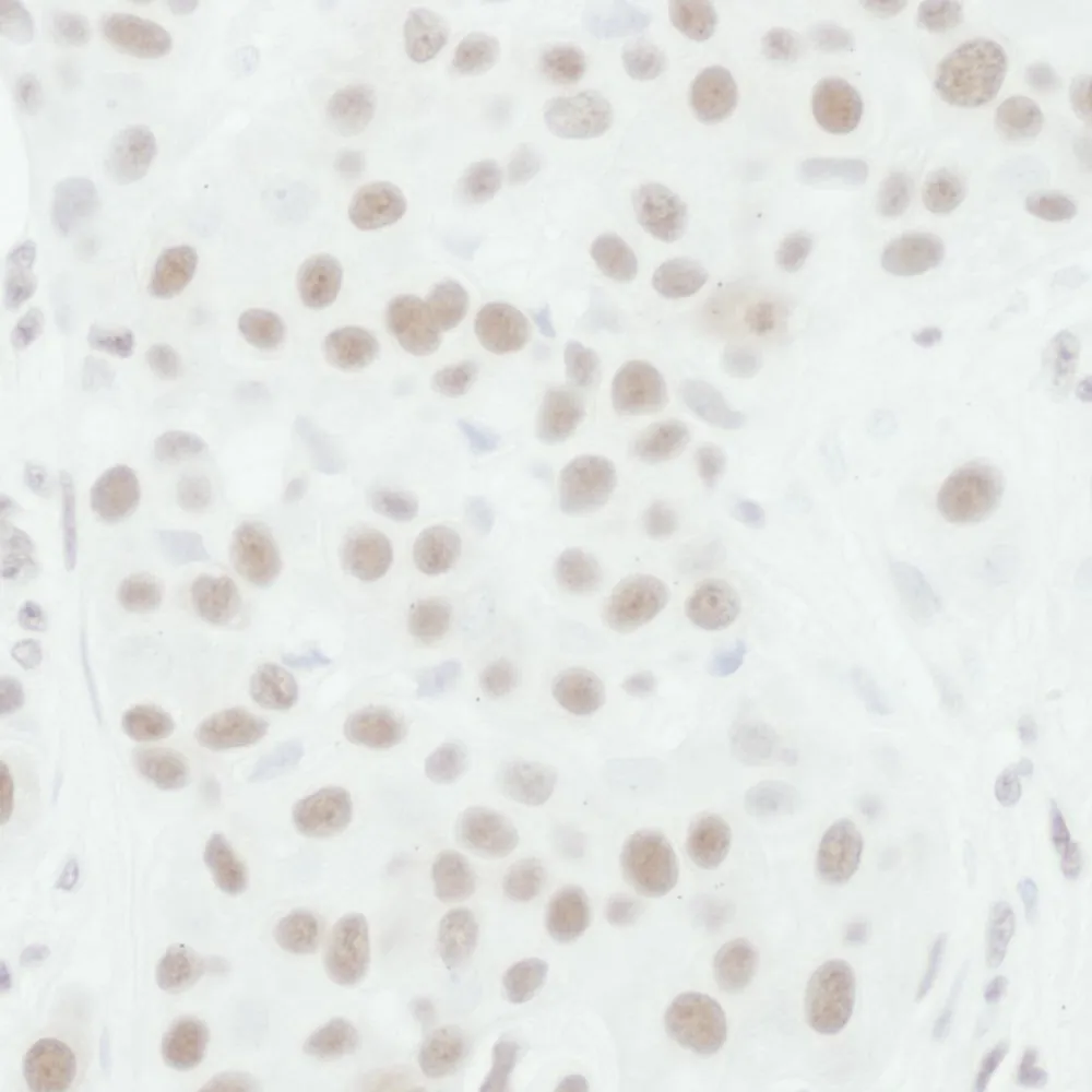 Goat anti-Phospho MEK1 (T286) Antibody, Affinity Purified