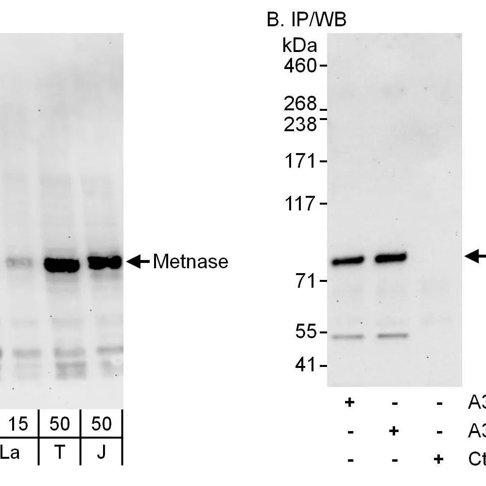 Rabbit anti-Metnase Antibody, Affinity Purified