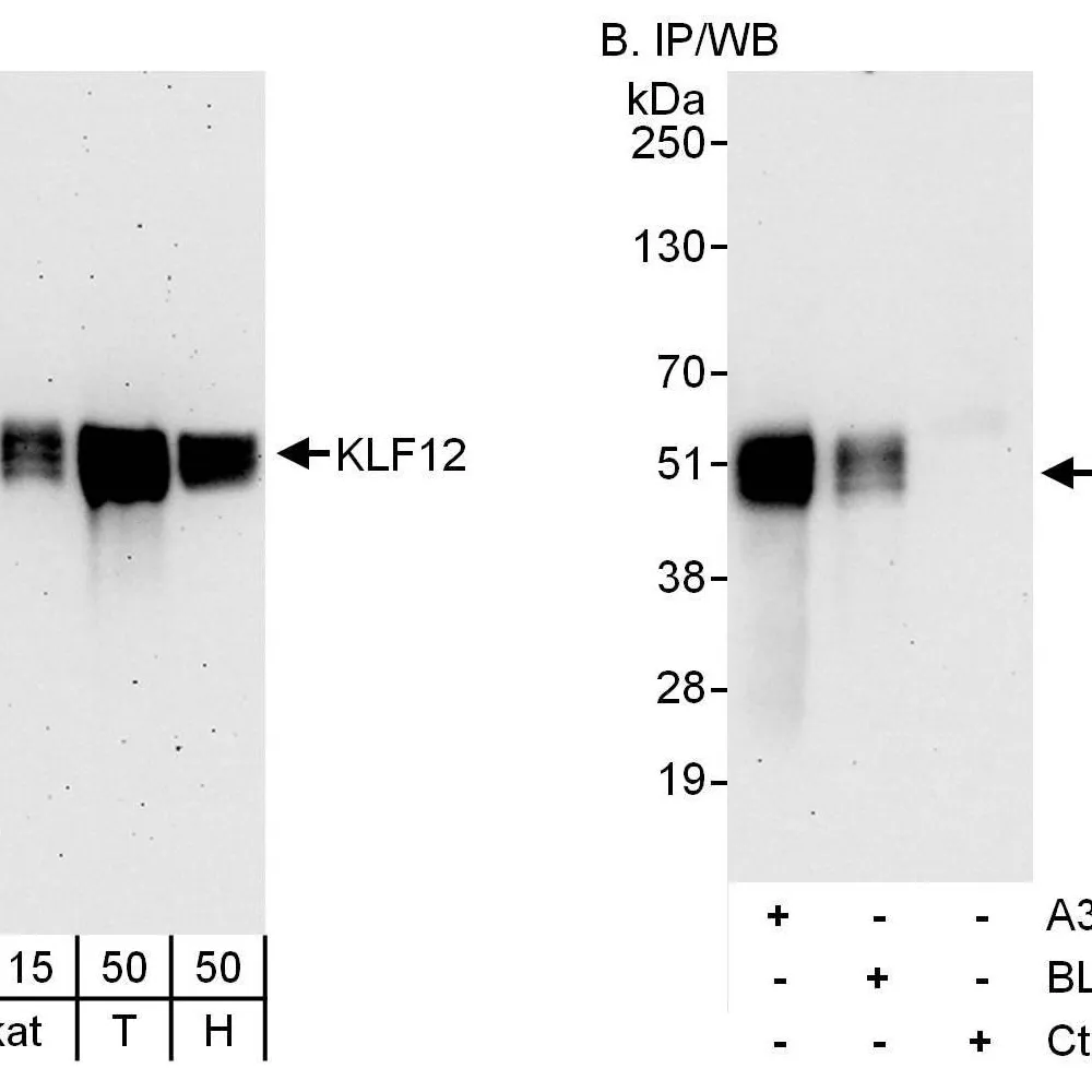 Rabbit anti-KLF12 Antibody, Affinity Purified