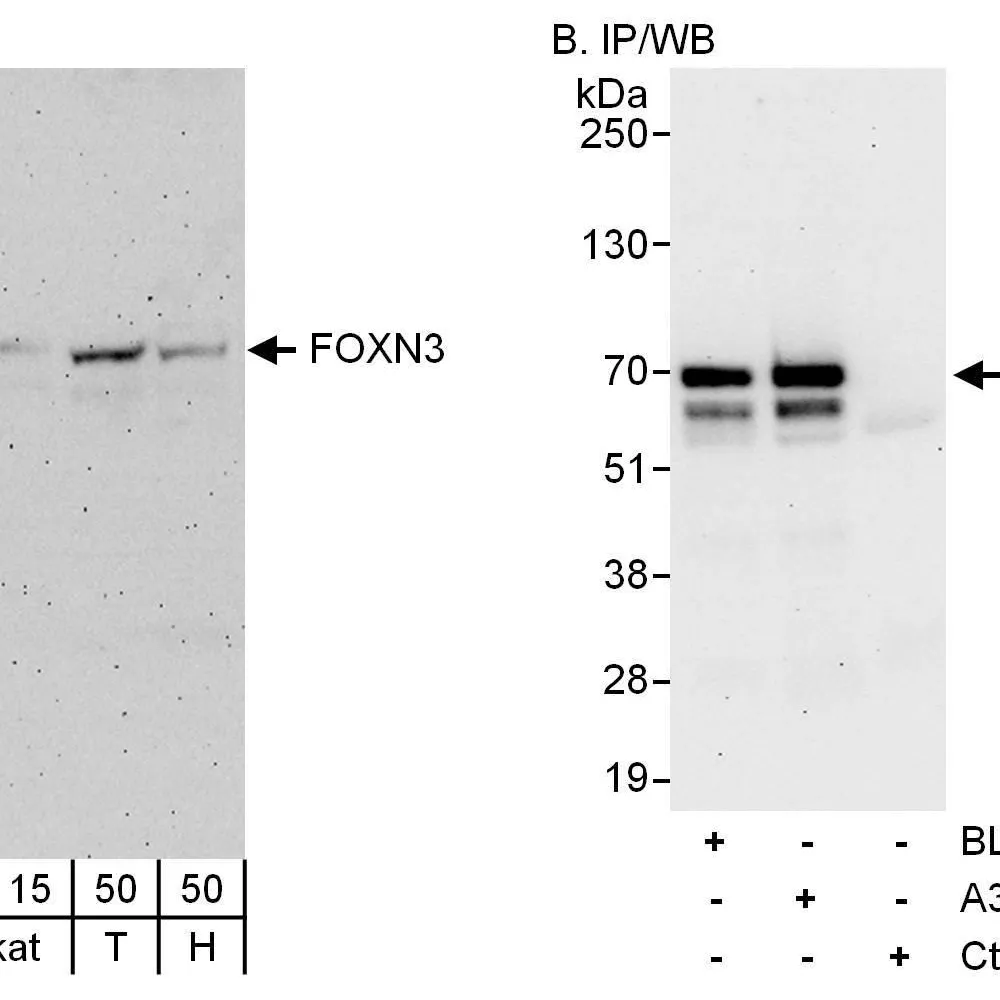 Rabbit anti-FOXN3 Antibody, Affinity Purified