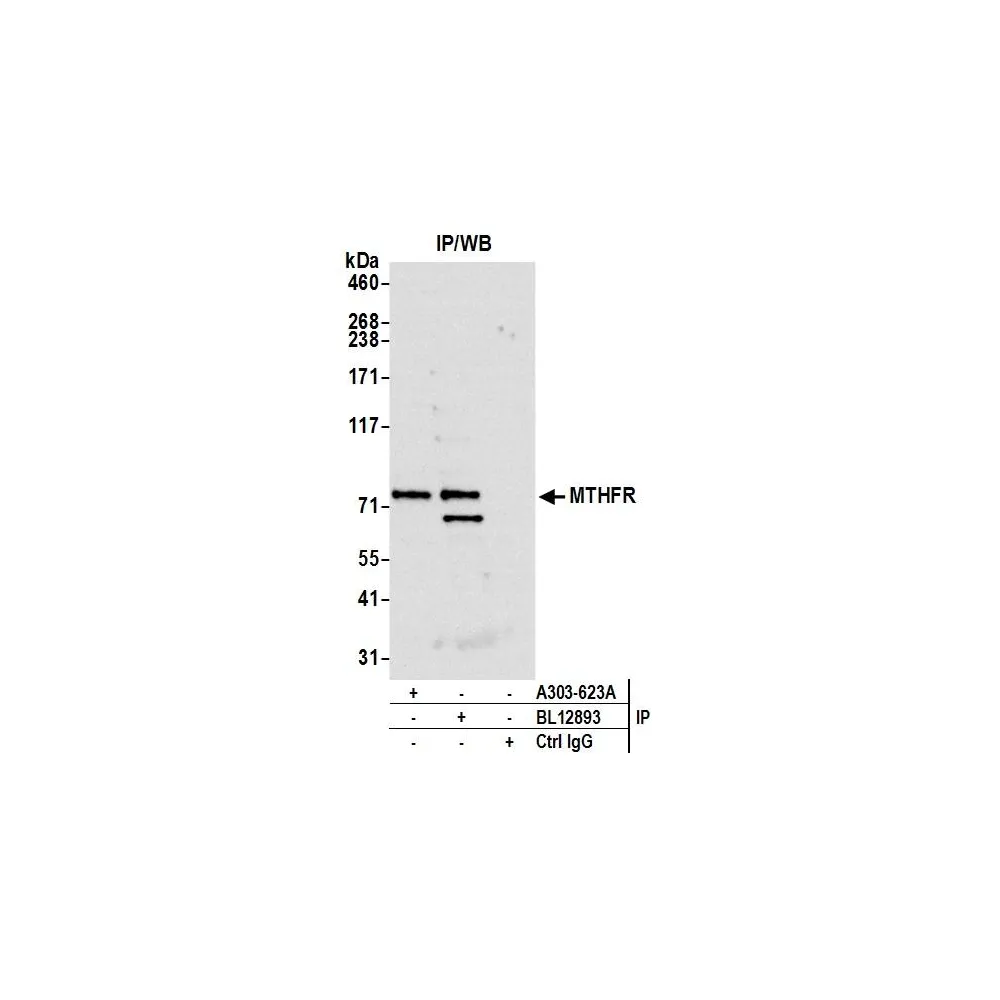 Rabbit anti-MTHFR Antibody, Affinity Purified