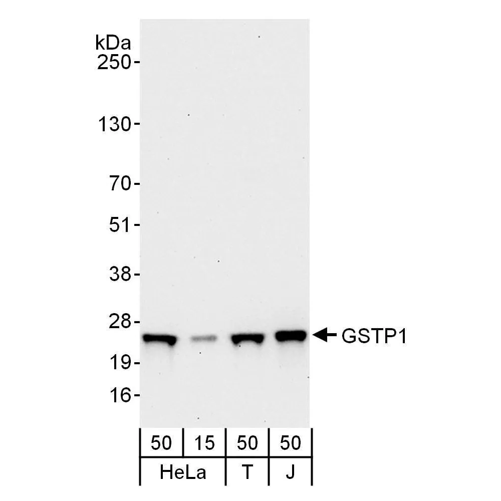 Rabbit anti-GSTP1 Antibody, Affinity Purified