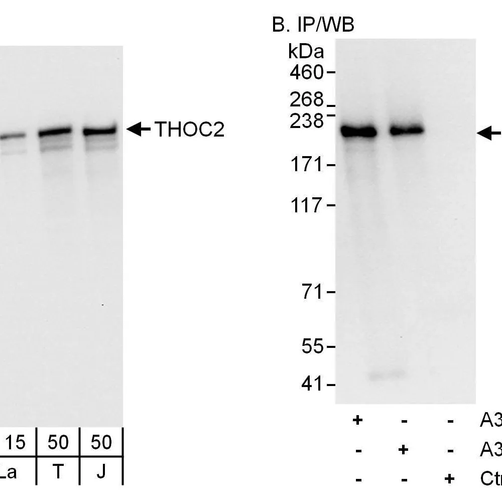 Rabbit anti-THOC2 Antibody, Affinity Purified