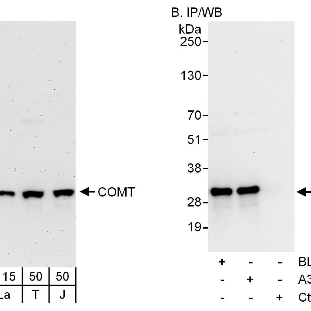 Rabbit anti-COMT Antibody, Affinity Purified