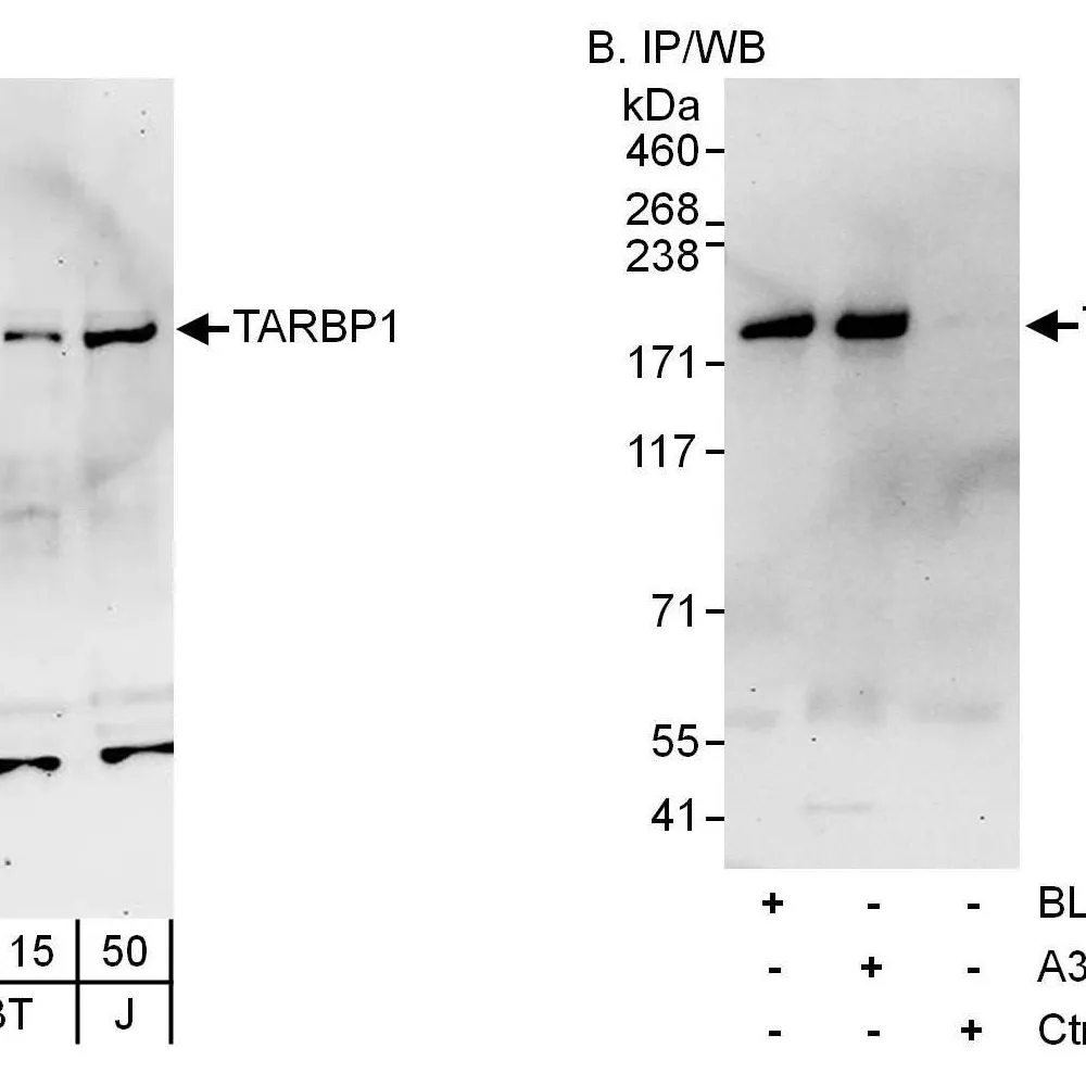 Rabbit anti-TARBP1 Antibody, Affinity Purified