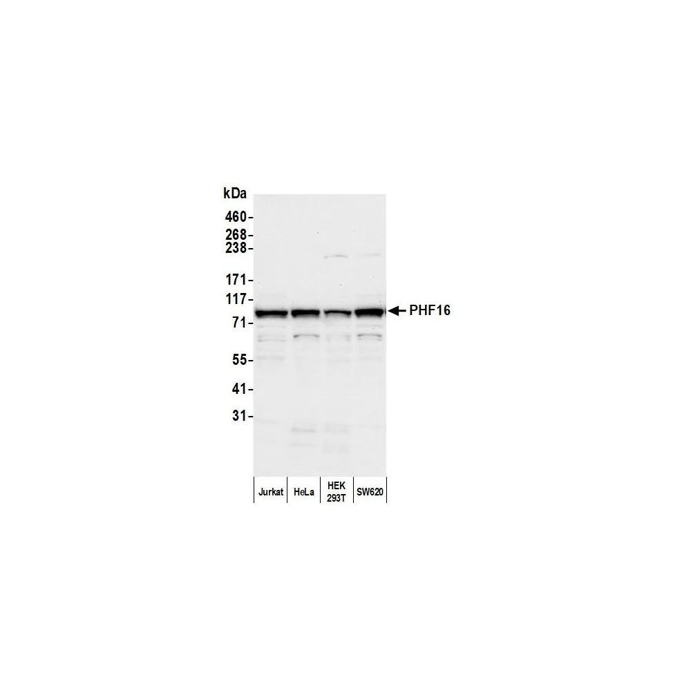 Rabbit anti-PHF16 Antibody, Affinity Purified
