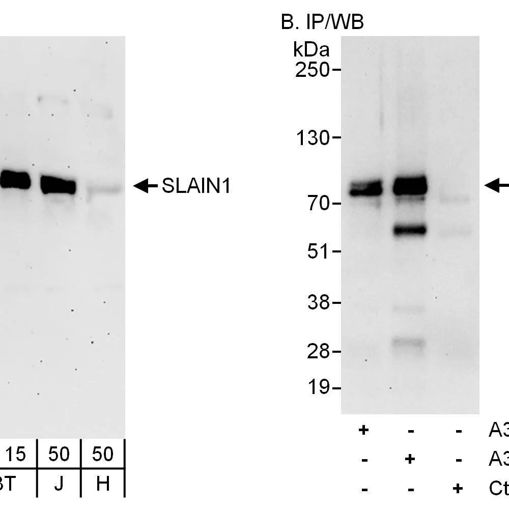 Rabbit anti-SLAIN1 Antibody, Affinity Purified