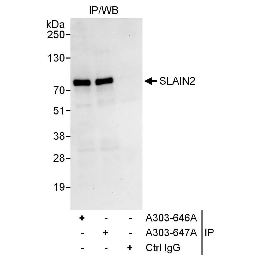 Rabbit anti-SLAIN2 Antibody, Affinity Purified