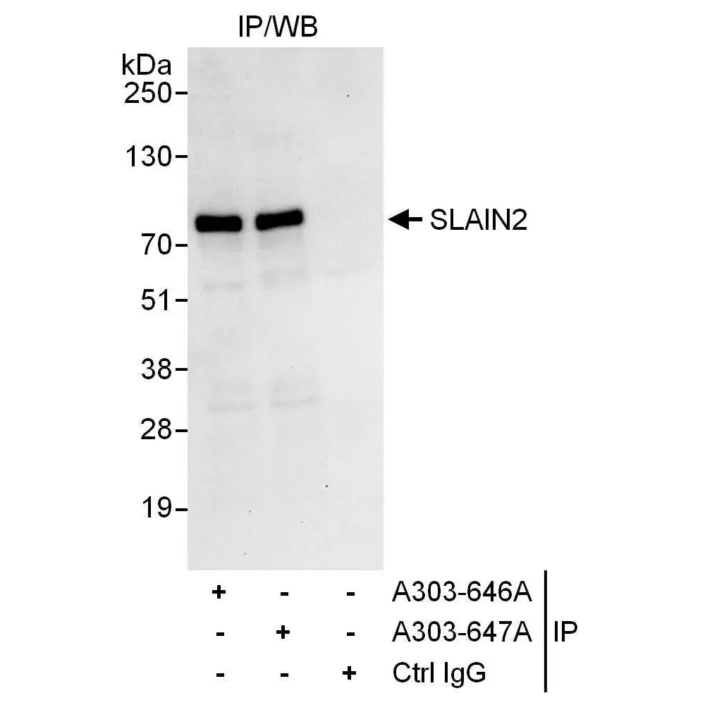 Rabbit anti-SLAIN2 Antibody, Affinity Purified