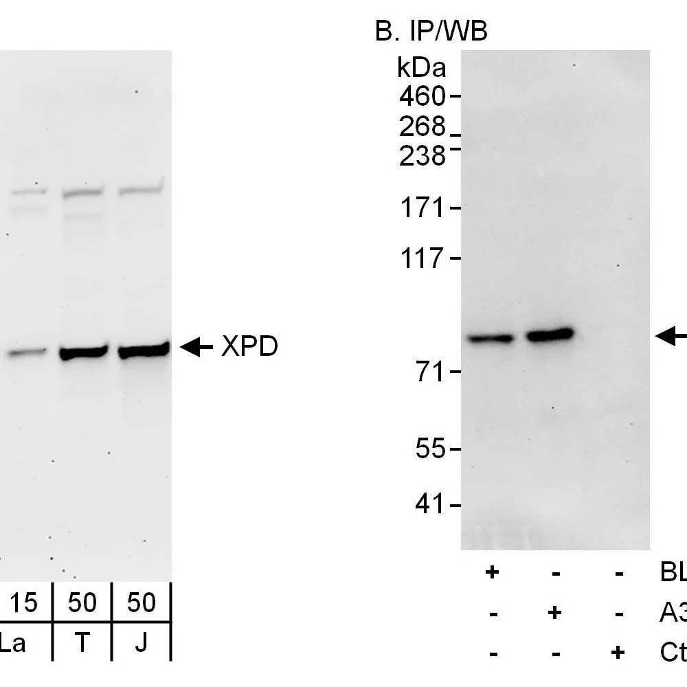 Rabbit anti-XPD Antibody, Affinity Purified