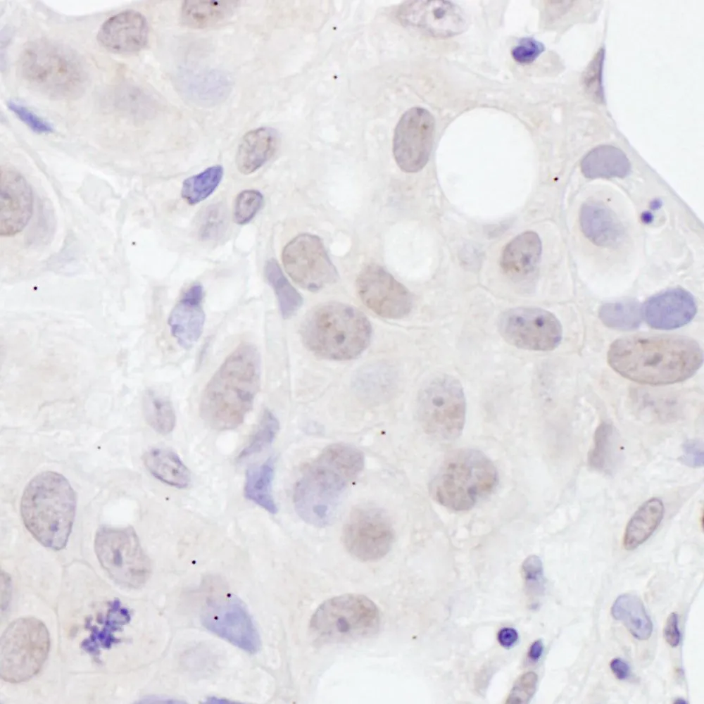 Rabbit anti-U2AF65 Antibody, Affinity Purified