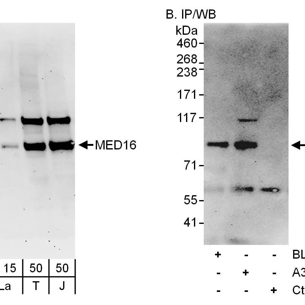 Rabbit anti-MED16 Antibody, Affinity Purified