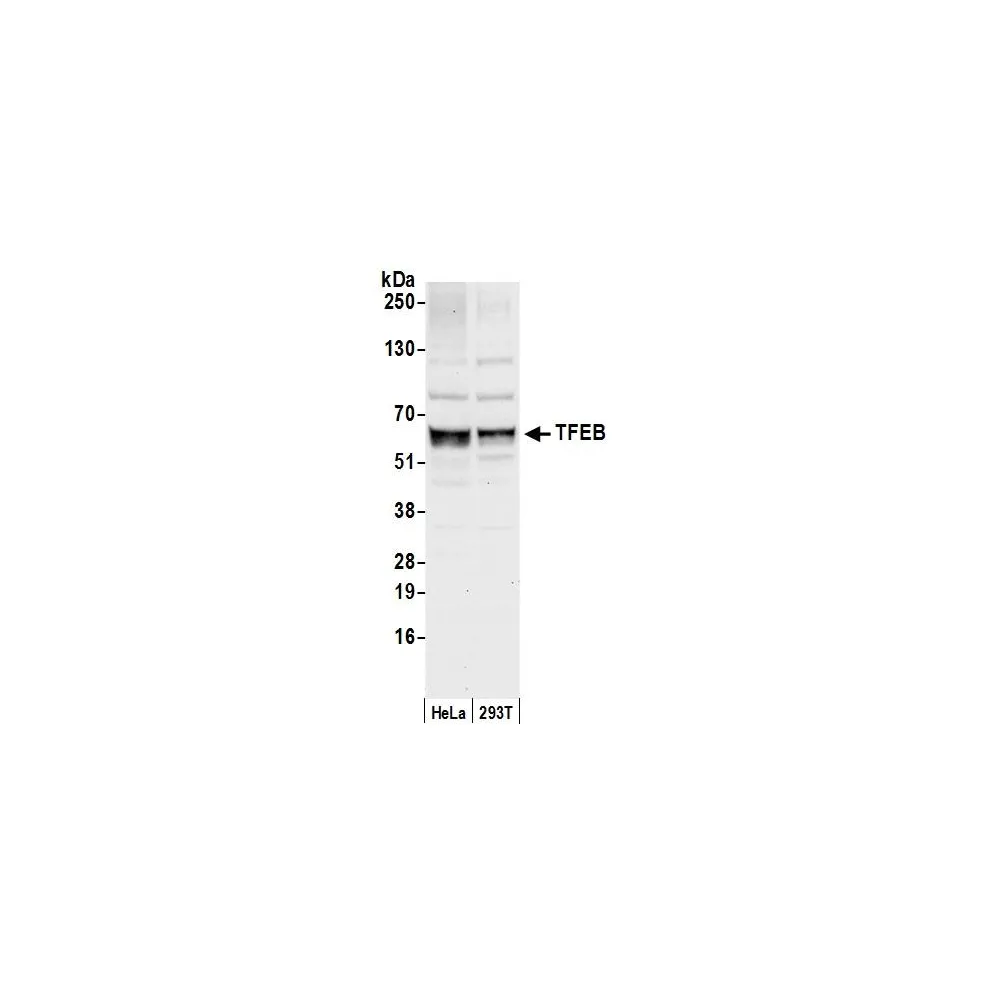 Rabbit anti-TFEB Antibody, Affinity Purified