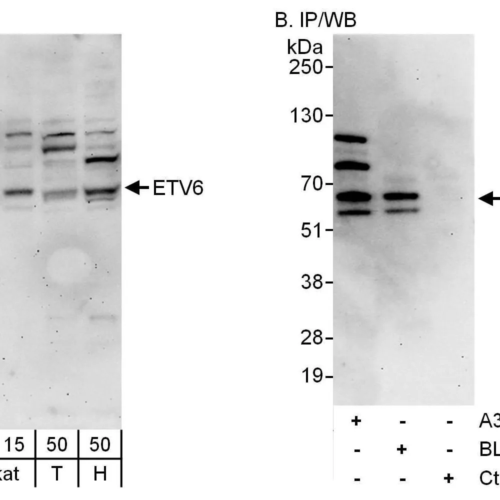 Rabbit anti-ETV6 Antibody, Affinity Purified