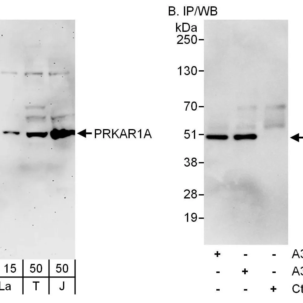 Rabbit anti-PRKAR1A Antibody, Affinity Purified