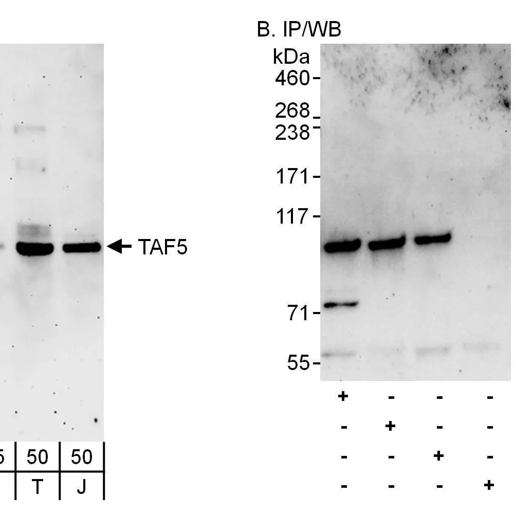 Rabbit anti-TAF5 Antibody, Affinity Purified